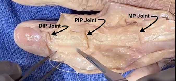 Anatomic Image of DIP Joint, PIP Joint and MP Joints.